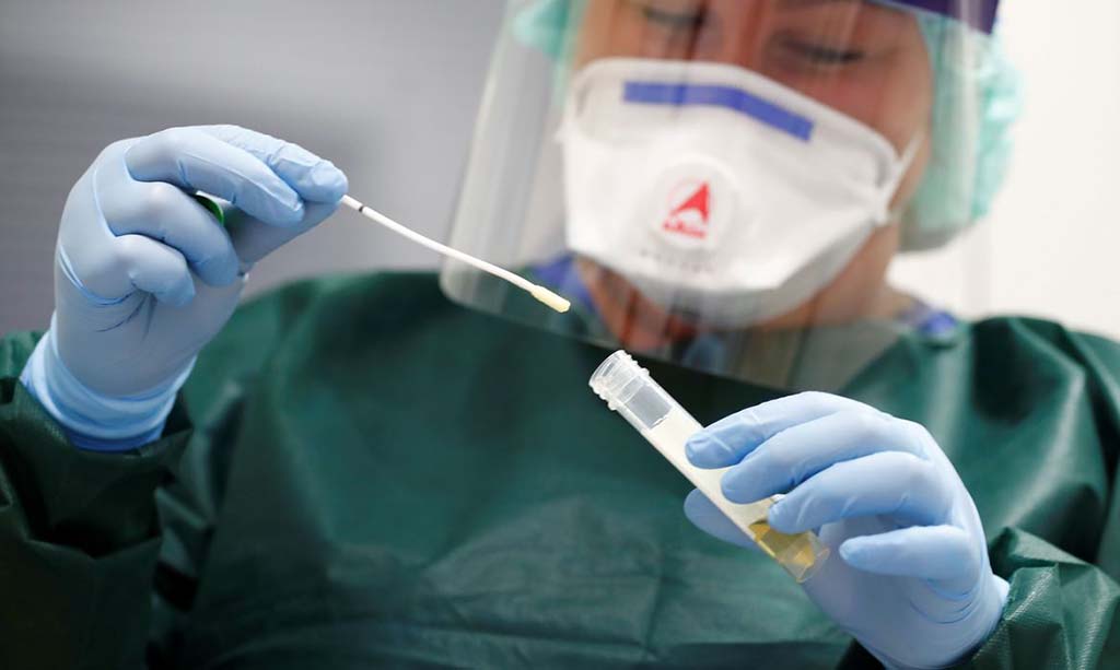 Saúde registra 158 novos casos de coronavírus e 5 óbitos, na quarta-feira, 21