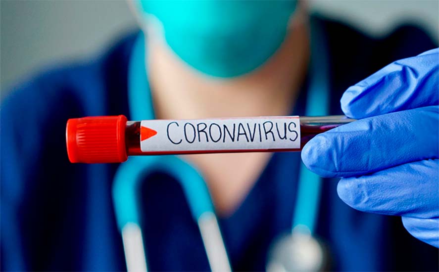 Saúde de Maringá registra 86 novos casos de coronavírus e 3 óbitos na quarta (22)