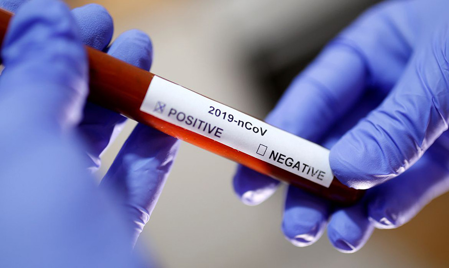 Novo boletim da Saúde registra 112 novos casos de coronavírus na quarta (29)